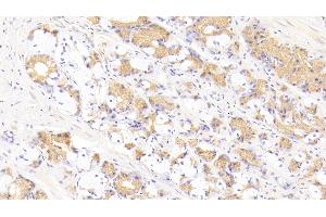 Detection of FASL in Human Stomach Tissue using Polyclonal Antibody to Factor Related Apoptosis Ligand (FASL) (FASL 抗体  (AA 103-281))