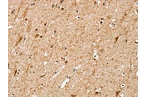 The image on the left is immunohistochemistry of paraffin-embedded Human brain tissue using ABIN7192648(SRP68 Antibody) at dilution 1/25, on the right is treated with synthetic peptide. (SRP68 抗体)