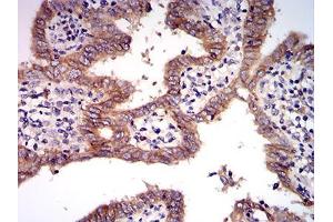 Immunohistochemistry (IHC) image for anti-Met Proto-Oncogene (MET) (AA 743-932) antibody (ABIN5542707)