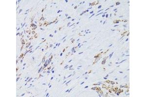 Immunohistochemistry (Paraffin-embedded Sections) (IHC (p)) image for anti-Glycine Amidinotransferase (L-Arginine:glycine Amidinotransferase) (GATM) antibody (ABIN7262473)