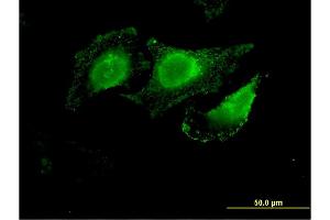 Immunofluorescence of monoclonal antibody to SLC12A2 on HeLa cell. (SLC12A2 抗体  (AA 903-1010))