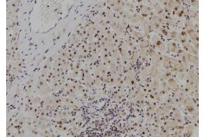 ABIN6278982 at 1/100 staining Human liver tissue by IHC-P. (MYCNOS 抗体)