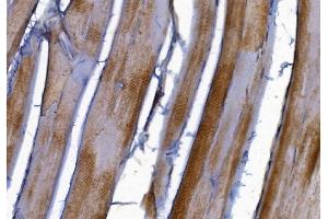 IHC analysis of PAK2 using anti-PAK2 antibody (ABIN7599219). (PAK2 抗体  (AA 1-288))
