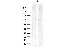 Western blot analysis of lysates from COLO205 cells, using Phospho-E2F1 (Thr433) Mouse Monoclonal Antibody at 1/1000 dilution.