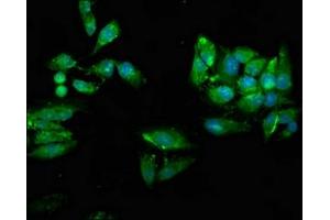 Immunofluorescence staining of Hela cells with ABIN7174472 at 1:66, counter-stained with DAPI. (UBE2N 抗体  (AA 20-138))