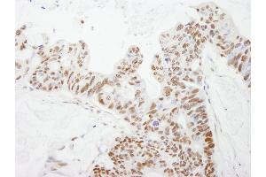 Immunohistochemistry (IHC) image for anti-DNA Fragmentation Factor, 45kDa, alpha Polypeptide (DFFA) (AA 271-331) antibody (ABIN7448951)