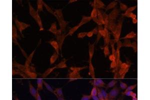 Immunofluorescence analysis of NIH-3T3 cells using UBE2G2 Polyclonal Antibody at dilution of 1:100. (UBE2G2 抗体)