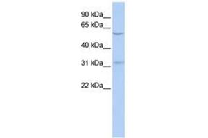Image no. 1 for anti-Nucleus Accumbens Associated 1, BEN and BTB (POZ) Domain Containing (NACC1) (AA 252-301) antibody (ABIN6742506)