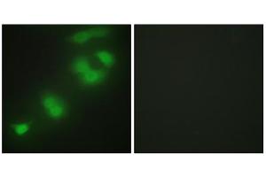 Immunofluorescence analysis of HepG2 cells, using CREBZF antibody. (CREBZF 抗体  (C-Term))