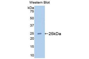 Western Blotting (WB) image for anti-Apolipoprotein M (APOM) (AA 20-190) antibody (ABIN1175641) (Apolipoprotein M 抗体  (AA 20-190))