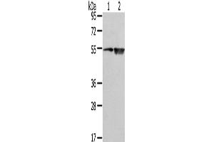 Western Blot analysis of TM4 cell and Human placenta tissue using EAAT3 Polyclonal Antibody at dilution of 1/500 (SLC1A1 抗体)