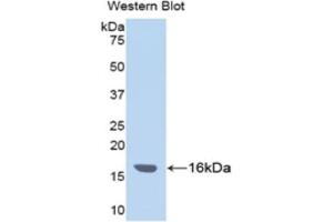 Detection of Recombinant ITIH4, Human using Polyclonal Antibody to Inter Alpha-Globulin Inhibitor H4 (ITIH4) (ITIH4 抗体  (AA 29-157))