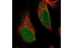 Immunofluorescent staining of human cell line U-2 OS with SRCAP polyclonal antibody  at 1-4 ug/mL dilution shows positivity in nucleus. (SRCAP 抗体)