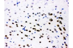 Immunohistochemistry (IHC) image for anti-Activating Transcription Factor 2 (ATF2) (AA 93-450) antibody (ABIN3029845)