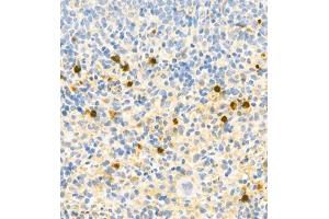 Immunohistochemistry (Paraffin-embedded Sections) (IHC (p)) image for anti-S100 Calcium Binding Protein A9 (S100A9) antibody (ABIN7075497)