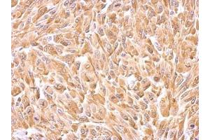 IHC-P Image HSP27 antibody detects HSPB1 protein at cytosol on U87 xenograft by immunohistochemical analysis. (HSP27 抗体  (Center))