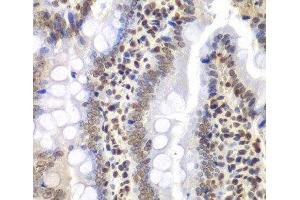 Immunohistochemistry of paraffin-embedded Rat intestine using PSMC3 Polyclonal Antibody at dilution of 1:200 (40x lens). (PSMC3 抗体)