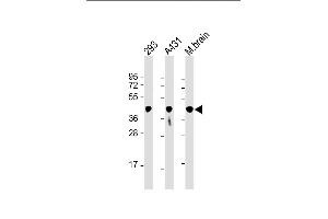 All lanes : Anti-PGK1 Antibody at 1:8000 dilution Lane 1: 293 whole cell lysate Lane 2: A431 whole cell lysate Lane 3: mouse brain lysate Lysates/proteins at 20 μg per lane. (PGK1 抗体  (AA 1-417))