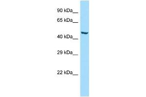 WB Suggested Anti-GMCL1 Antibody Titration: 1. (GMCL1 抗体  (C-Term))