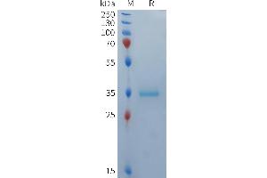 Human BCMA(1-42) Protein, mFc Tag on SDS-PAGE under reducing condition.