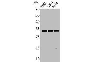Western Blot analysis of K562 22RV-1 H460 cells using SCP-3 Polyclonal Antibody (SYCP3 抗体  (Internal Region))