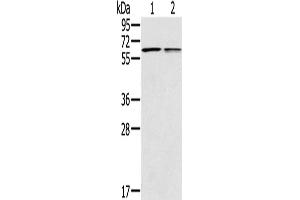 Western Blotting (WB) image for anti-Prostaglandin E Receptor 2 (Subtype EP2), 53kDa (PTGER2) antibody (ABIN2433631) (PTGER2 抗体)