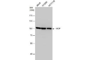 WB Image VCP antibody detects VCP protein by western blot analysis. (VCP 抗体  (C-Term))