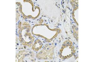 Immunohistochemistry of paraffin-embedded human kidney using ICOSL Antibody (ABIN6130065, ABIN6142131, ABIN6142132 and ABIN6222879) at dilution of 1:100 (40x lens). (ICOSLG 抗体  (AA 19-256))