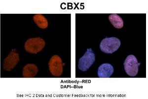Sample Type :  Human NT-2 cells   Primary Antibody Dilution :  1:500  Secondary Antibody :  Goat anti-rabbit Alexa-Fluor 594  Secondary Antibody Dilution :  1:1000  Color/Signal Descriptions :  CBX5: Red DAPI:Blue  Gene Name :  CBX5  Submitted by :  Dr. (CBX5 抗体  (Middle Region))