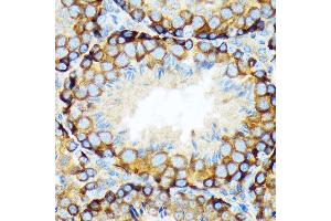 Immunohistochemistry of paraffin-embedded mouse testis using K/Elp3 Rabbit mAb (ABIN1680361, ABIN3015008, ABIN3015009 and ABIN7101302) at dilution of 1:100 (40x lens). (ELP3/KAT9 抗体)