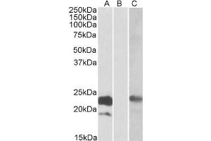 HEK293 lysate (10ug protein in RIPA buffer) overexpressing Human CST8 with C-terminal MYC tag probed with antibody (0. (CST8 抗体  (Internal Region))