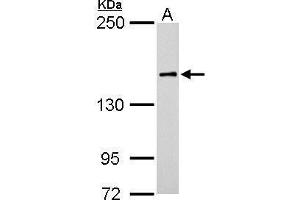 WB Image ROCK1 antibody [N1N2], N-term detects ROCK1 protein by Western blot analysis.