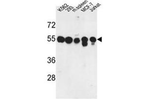 Western blot analysis of PPM1H Antibody in K562, 293, MCF-7, Jurkat cell line and mouse spleen tissue lysates (35ug/lane). (PPM1H 抗体  (Middle Region))