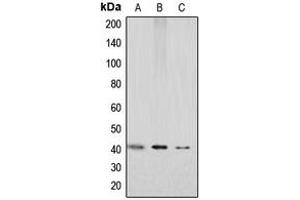 Western blot analysis of GPR159 expression in HEK293T (A), mouse kidney (B), rat kidney (C) whole cell lysates.