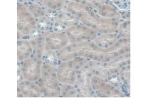 Detection of MCP1 in Mouse Kidney Tissue using Monoclonal Antibody to Monocyte Chemotactic Protein 1 (MCP1) (CCL2 抗体  (AA 24-96))