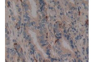 Immunohistochemistry (IHC) image for anti-CD40 (CD40) (AA 26-187) antibody (ABIN7442747)