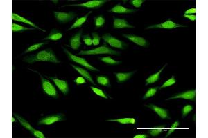 Immunofluorescence of purified MaxPab antibody to IGFBP3 on HeLa cell. (IGFBP3 抗体  (AA 1-291))