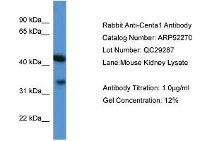 WB Suggested Anti-Centa1  Antibody Titration: 0. (ADAP1 抗体  (C-Term))