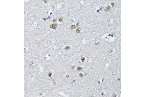 Immunohistochemistry (IHC) image for anti-Polypyrimidine Tract Binding Protein 2 (PTBP2) (AA 1-280) antibody (ABIN6146373)