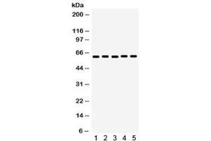Western blot testing of 1) rat kidney, 2) mouse kidney, 3) human COLO320, 4) human HepG2 and 5) mouse HEPA lysate with MAOA antibody. (Monoamine Oxidase A 抗体)