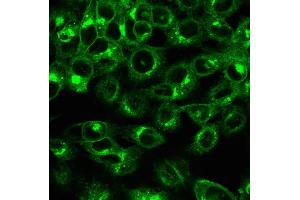 Immunofluorescence Analysis of HeLa cells labeling with Beta-2-Microglobulin Mouse Recombinant Monoclonal Antibody (rB2M/961) followed by Goat anti-mouse IgG-CF488 (Green). (Recombinant beta-2 Microglobulin 抗体)