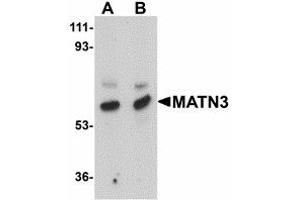 Image no. 1 for anti-Matrilin 3 (MATN3) (Internal Region) antibody (ABIN478078) (Matrilin 3 抗体  (Internal Region))