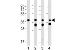 Western Blotting (WB) image for anti-Epithelial Cell Adhesion Molecule (EPCAM) (AA 217-251), (C-Term) antibody (ABIN3030861)