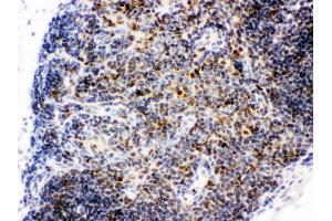 Immunohistochemistry (IHC) image for anti-C-terminal Binding Protein 1 (CTBP1) (AA 409-440), (C-Term) antibody (ABIN3043816)