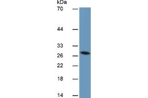 Mouse Detection antibody from the kit in WB with Positive Control:  Sample Human liver Tissue.