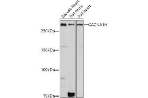 Western Blotting (WB) image for anti-Calcium Channel, Voltage-Dependent, T Type, alpha 1H Subunit (CACNA1H) (AA 260-360) antibody (ABIN7266015)