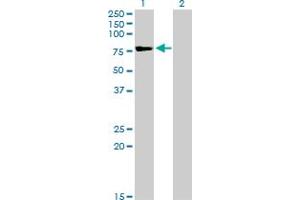 Western Blot analysis of TSGA10 expression in transfected 293T cell line by TSGA10 monoclonal antibody (M08), clone 6E8. (TSGA10 抗体  (AA 599-698))