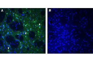 Expression of SLC25A18 in rat striatum: Immunohistochemical staining of perfusion-fixed frozen rat brain sections with Anti-SLC25A18 (GC2) Antibody (ABIN7581973), (1:300), followed by goat anti-rabbit-AlexaFluor-488.