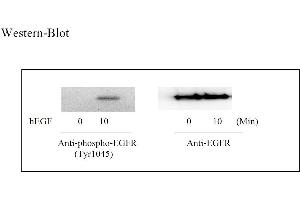 Image no. 4 for Epidermal Growth Factor Receptor (EGFR) ELISA Kit (ABIN625235) (EGFR ELISA 试剂盒)