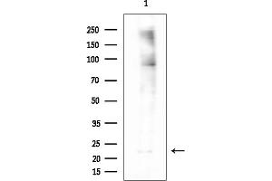 anti-Ubiquitin-Conjugating Enzyme E2E 3 (UBE2E3) (N-Term) antibody